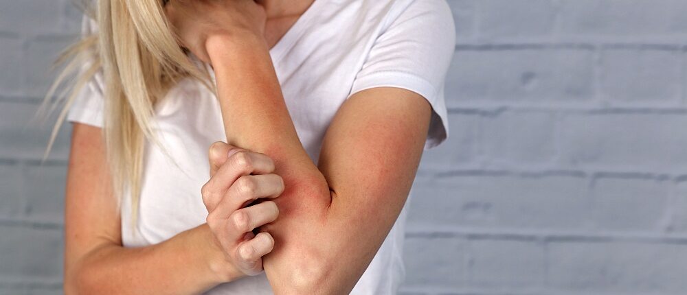 Feature | Natural Remedies for Skin Rash | Skin rashes that itch