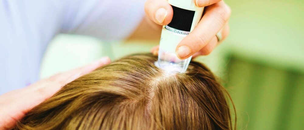 Feature | Best Treatment For Scalp Psoriasis | scalp psoriasis causes