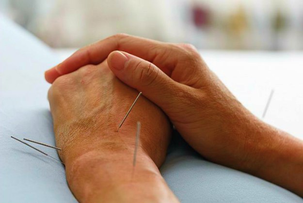 Insert Acupuncture Needles | CARPAL TUNNEL TREATMENT AND PAIN RELIEF