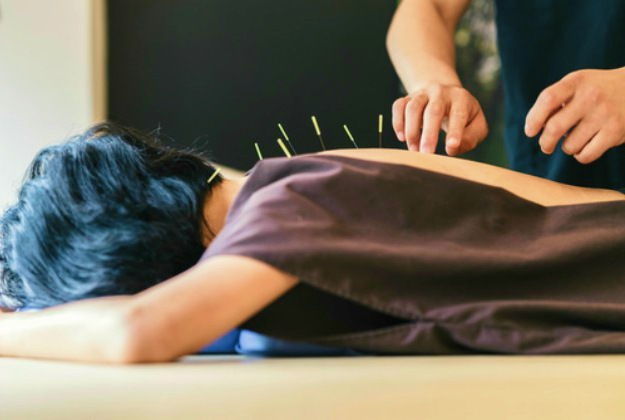 Acupuncture | Pain Relief Alternatives To Ibuprofen | pain