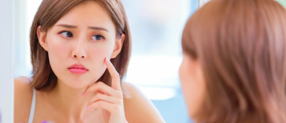 Feature | What Causes Acne | FAQs | About acne