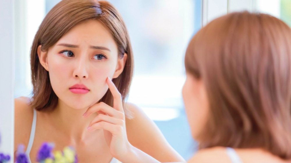 Feature | What Causes Acne | FAQs | About acne