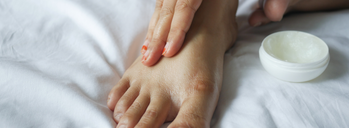 Close-up of antifungal cream application on infected toenail, showcasing the treatment process